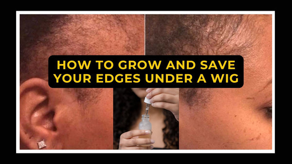 How To Grow And Save Your Edges Under A Wig